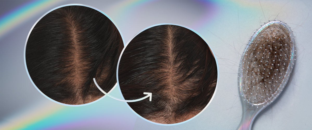 how much hair loss is normal? and why am I always shedding?