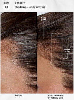 FutureIQ™ Biomimetic Hair Longevity Serum 90 ml