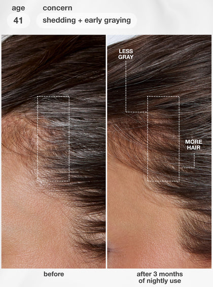 FutureIQ™ Biomimetic Hair Longevity Serum 90 ml