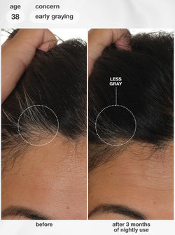 FutureIQ™ Biomimetic Hair Longevity Serum 90 ml