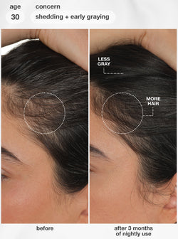 FutureIQ™ Biomimetic Hair Longevity Serum 90 ml